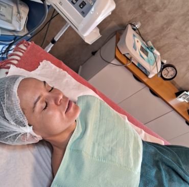 Foto de resultado de Jato de Plasma para manchas e flacidez