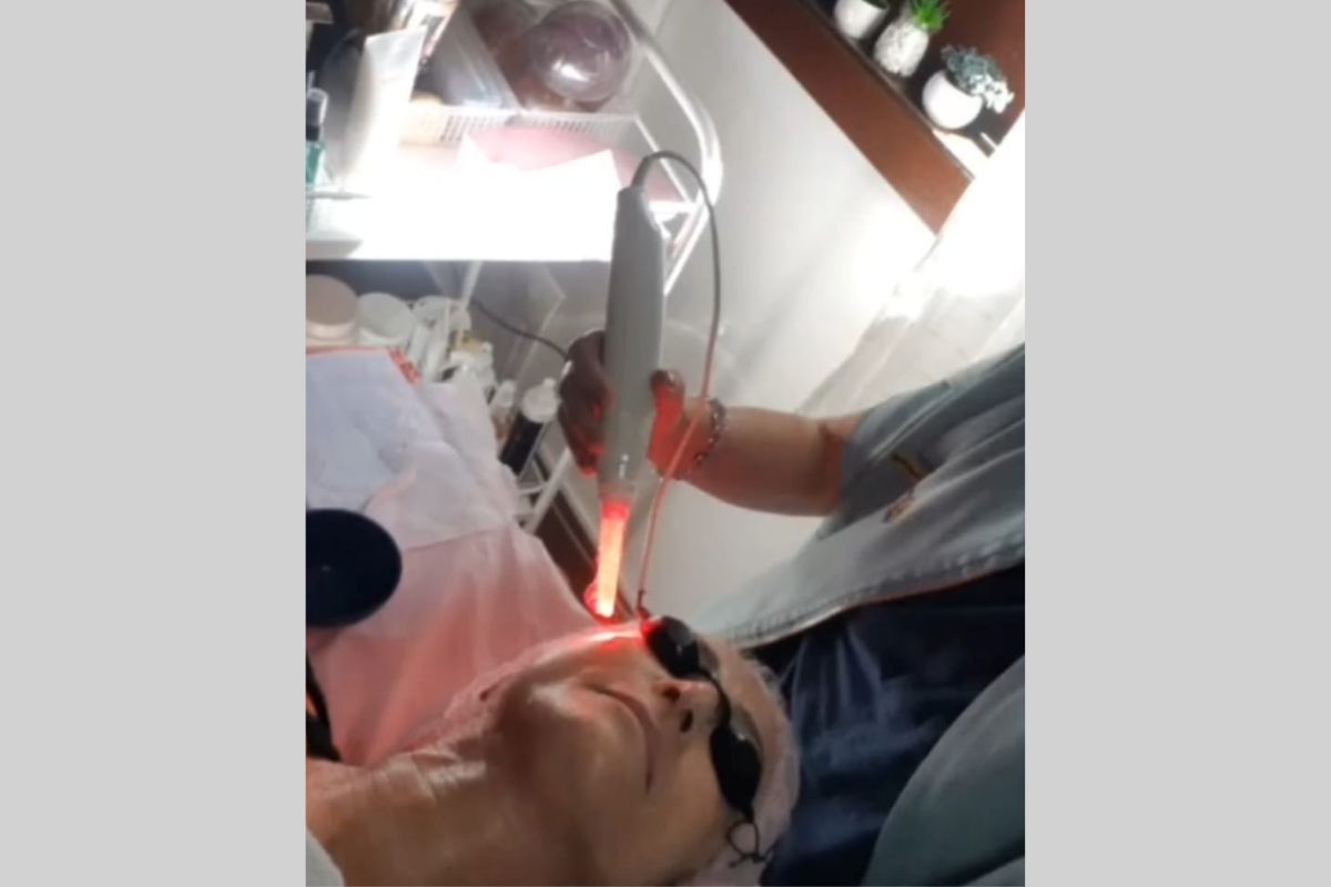 Laserterapia Facial - Essência da Estética