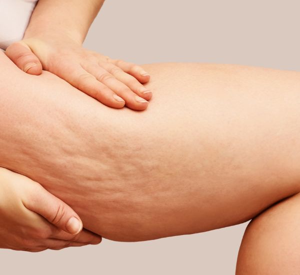 Tratamento de emagrecimento saudável e redução de medidas na Essência da Estética