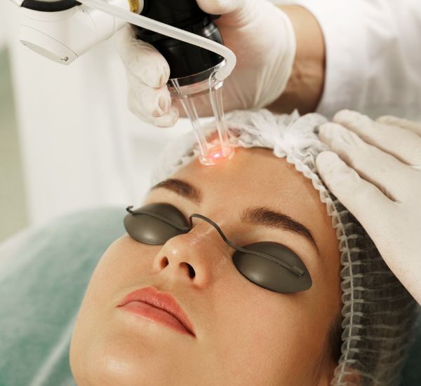 Intradermo terapia Facial