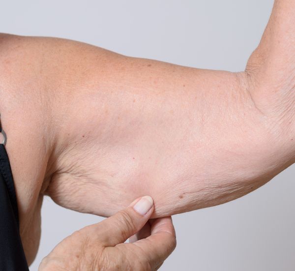 Tratamento de emagrecimento saudável e redução de medidas na Essência da Estética